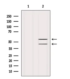 Anti-JNK antibody used in Western Blot (WB). GTX52360