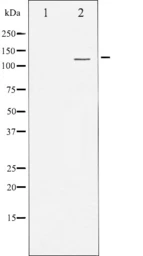 Anti-PKD1/2/3/PKC micro antibody used in Western Blot (WB). GTX52375