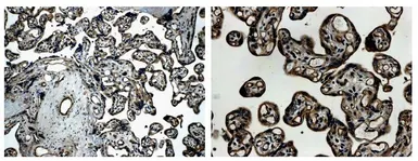 Anti-TIE2 antibody [21G7] used in IHC (Paraffin sections) (IHC-P). GTX52471