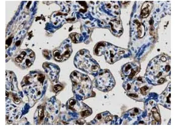 Anti-MMP13 antibody [12E10] used in IHC (Paraffin sections) (IHC-P). GTX52479