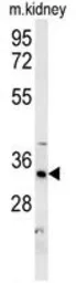 Anti-HSD17B13 antibody used in Western Blot (WB). GTX53602