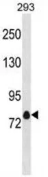 Anti-Kv1.4 antibody used in Western Blot (WB). GTX53679