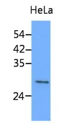 Anti-Stomatin antibody [AT33F5] used in Western Blot (WB). GTX53788