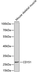 Anti-CD151 antibody used in Western Blot (WB). GTX53914