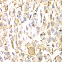 Anti-CD151 antibody used in IHC (Paraffin sections) (IHC-P). GTX53914