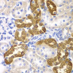 Anti-CD151 antibody used in IHC (Paraffin sections) (IHC-P). GTX53914