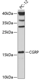 Anti-CGRP antibody used in Western Blot (WB). GTX53926