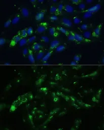 Anti-CGRP antibody used in Immunocytochemistry/ Immunofluorescence (ICC/IF). GTX53926