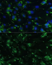 Anti-CGRP antibody used in Immunocytochemistry/ Immunofluorescence (ICC/IF). GTX53926