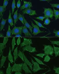 Anti-CGRP antibody used in Immunocytochemistry/ Immunofluorescence (ICC/IF). GTX53926