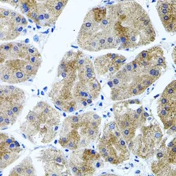 Anti-CDH23 antibody used in IHC (Paraffin sections) (IHC-P). GTX53952