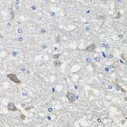 Anti-CDH23 antibody used in IHC (Paraffin sections) (IHC-P). GTX53952