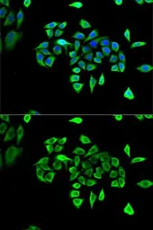 Anti-CLCN5 antibody used in Immunocytochemistry/ Immunofluorescence (ICC/IF). GTX53963