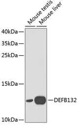 Anti-DEFB132 antibody used in Western Blot (WB). GTX53990