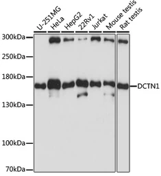 Anti-DCTN1 antibody used in Western Blot (WB). GTX54021