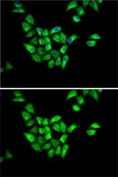 Anti-DCTN1 antibody used in Immunocytochemistry/ Immunofluorescence (ICC/IF). GTX54021