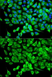 Anti-EIF4A1 antibody used in Immunocytochemistry/ Immunofluorescence (ICC/IF). GTX54032