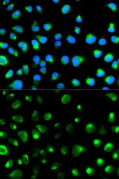 Anti-Glycophorin C antibody used in Immunocytochemistry/ Immunofluorescence (ICC/IF). GTX54084