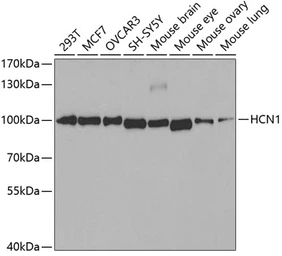 Anti-HCN1 antibody used in Western Blot (WB). GTX54130