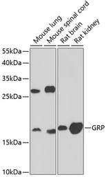 Anti-GRP antibody used in Western Blot (WB). GTX54161