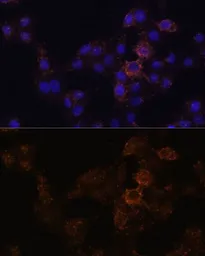 Anti-GRP antibody used in Immunocytochemistry/ Immunofluorescence (ICC/IF). GTX54161