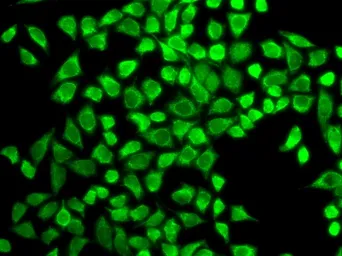 Anti-IL7 Receptor alpha antibody used in Immunocytochemistry/ Immunofluorescence (ICC/IF). GTX54311