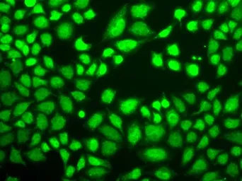 Anti-LSD1 antibody used in Immunocytochemistry/ Immunofluorescence (ICC/IF). GTX54328