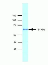 Anti-MARVELD2 antibody used in Western Blot (WB). GTX54515