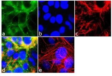 Anti-MARVELD2 antibody used in Immunocytochemistry/ Immunofluorescence (ICC/IF). GTX54515