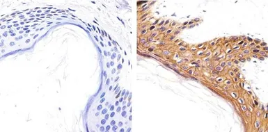 Anti-Syndecan-1 / CD138 antibody used in IHC (Paraffin sections) (IHC-P). GTX54537