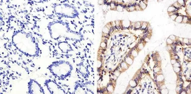 Anti-Syndecan-1 / CD138 antibody used in IHC (Paraffin sections) (IHC-P). GTX54537