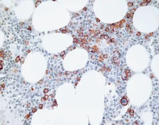 Anti-Syndecan-1 / CD138 antibody used in IHC (Paraffin sections) (IHC-P). GTX54537