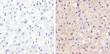 Anti-Claudin 1 antibody used in IHC (Paraffin sections) (IHC-P). GTX54539