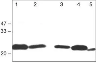 Anti-Claudin 1 antibody used in Western Blot (WB). GTX54539