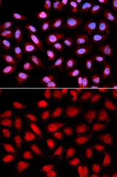 Anti-PPP2R4 antibody used in Immunocytochemistry/ Immunofluorescence (ICC/IF). GTX54592