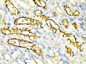 Anti-PPP2R4 antibody used in IHC (Paraffin sections) (IHC-P). GTX54592