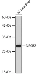 Anti-NR0B2 antibody used in Western Blot (WB). GTX54598