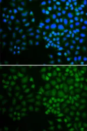 Anti-NR0B2 antibody used in Immunocytochemistry/ Immunofluorescence (ICC/IF). GTX54598