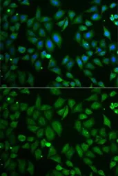 Anti-Chromogranin C antibody used in Immunocytochemistry/ Immunofluorescence (ICC/IF). GTX54665