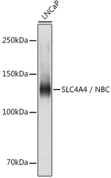 Anti-SLC4A4 antibody used in Western Blot (WB). GTX54676