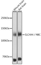 Anti-SLC4A4 antibody used in Western Blot (WB). GTX54676