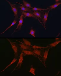 Anti-SLC4A4 antibody used in Immunocytochemistry/ Immunofluorescence (ICC/IF). GTX54676