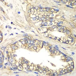 Anti-SLC4A4 antibody used in IHC (Paraffin sections) (IHC-P). GTX54676