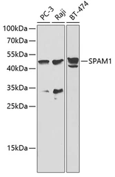 Anti-SPAM1 antibody used in Western Blot (WB). GTX54679