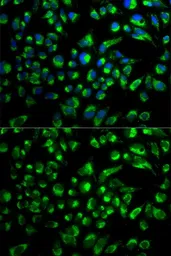 Anti-SPAM1 antibody used in Immunocytochemistry/ Immunofluorescence (ICC/IF). GTX54679