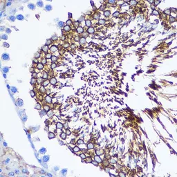 Anti-SPAM1 antibody used in IHC (Paraffin sections) (IHC-P). GTX54679