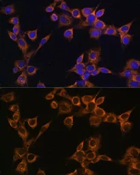 Anti-RAMP1 antibody used in Immunocytochemistry/ Immunofluorescence (ICC/IF). GTX54684