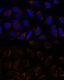 Anti-RAMP1 antibody used in Immunocytochemistry/ Immunofluorescence (ICC/IF). GTX54684