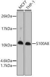 Anti-S100A8 antibody used in Western Blot (WB). GTX54721