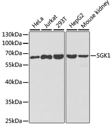 Anti-SGK1 antibody used in Western Blot (WB). GTX54726